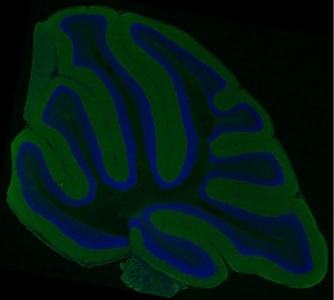 cerebellum